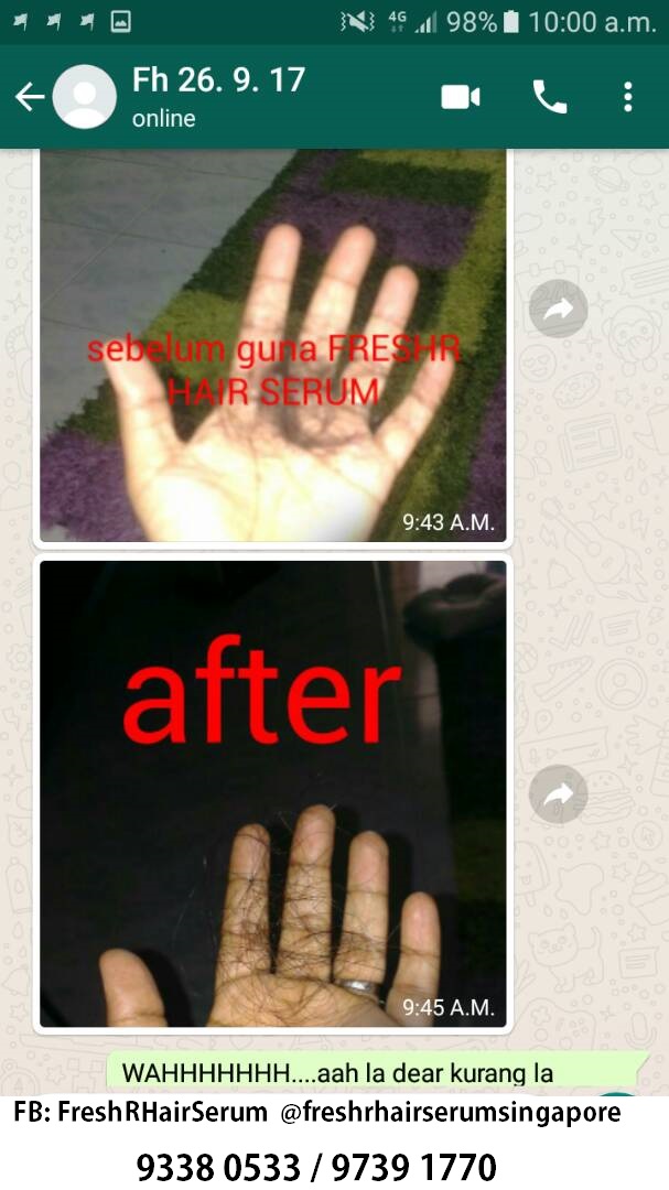 hair loss diagnosisI97391770