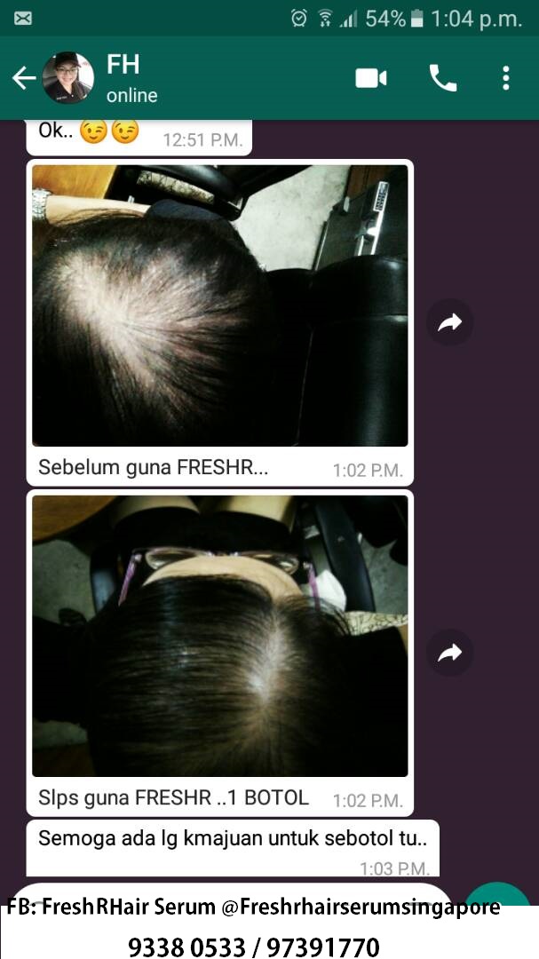 hair loss home remediesI97391770